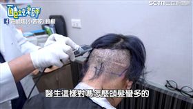 酷炫後面頭髮被剃掉。（圖／莊酷炫(小苦苓)臉書授權）