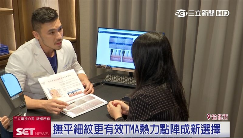 抗皺醫美新技術！Tixel提可塑