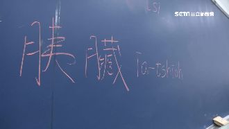 腎臟、胰臟台語怎麼念？民眾全被考倒