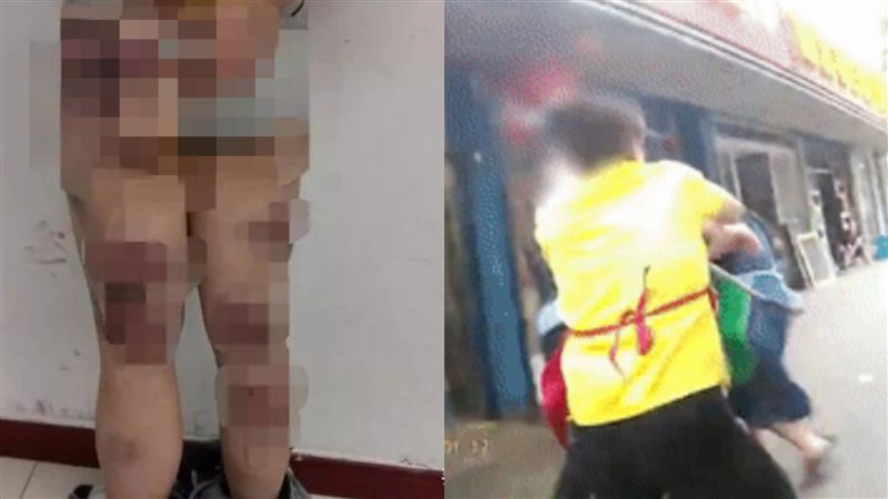 母鐵棍狂毆女兒…被求償34萬氣昏倒