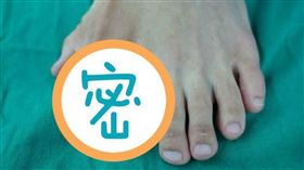 大陸,腳趾,多趾畸形,算命。(圖/翻攝自廣州日報)