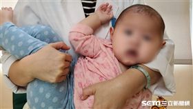 大千綜合醫院,復健科,陳克銘,先天肌肉性斜頸,歪脖子