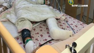 遭撞出車外又被輾！7歲童重傷恐截肢