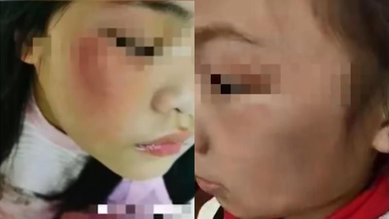 學生寫錯字被狂揍　師嗆家長：來打我