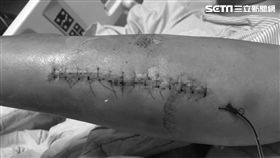 房仲遭毆 骨折送醫