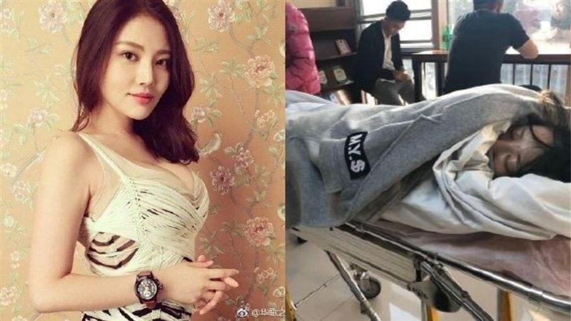 醫美診所動手術！女星爆出意外陷昏迷