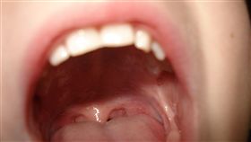 （圖／Pixabay）牙齒,牙醫,張嘴