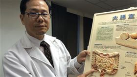 長時間同一部位腹痛　小心大腸癌警訊書田診所胃腸肝膽科主任醫師邱展賢8日指出，大腸癌常見的症狀包含不明原因腹痛超過1個月以上且疼痛位置固定、血便、貧血、體重減輕等。中央社記者陳偉婷攝　108年11月8日