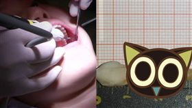 金氏紀錄,牙醫,人類最長牙齒,德國,牙痛,長牙