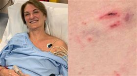 澳洲,遛狗,虎蛇,劇毒。(組合圖/翻攝自Louise Mahler臉書)