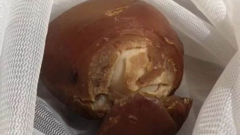 她宰雞驚見「豬腳蛋」　 網喊發財了