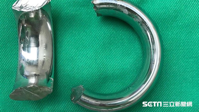 情趣環狠勒生殖器！醫竟找消防員電鋸