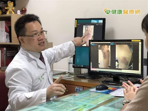 血友病預防性治療 維持凝血因子濃度更長效!