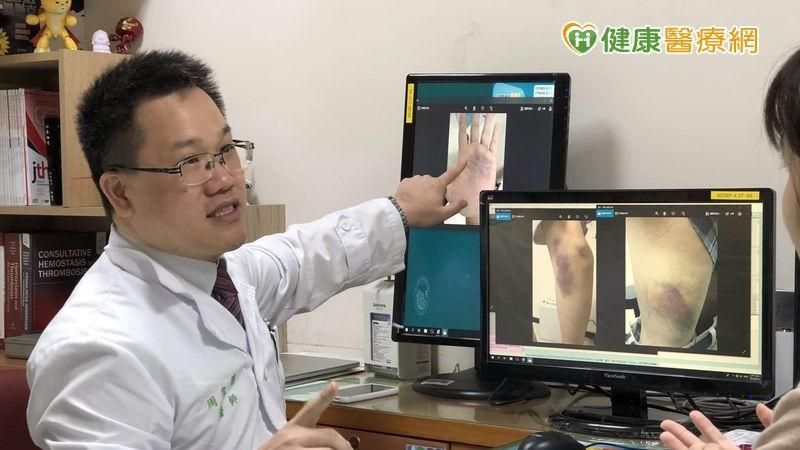 血友病預防性治療　維持凝血因子濃度