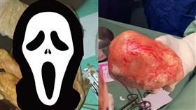 蘇丹,死胎,便祕,癌細胞,lithopedion,石化,木乃伊,鈣化,腹痛,風險,孕婦　圖／翻攝自推特