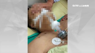 賣家遭斷手腳…死不瞑目「流血淚」亡