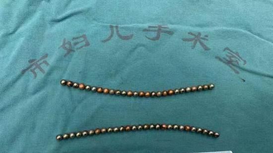 拿53顆磁珠塞尿道！男童爆血急求救
