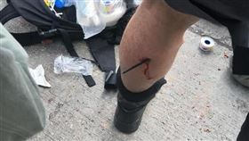 １６：９
港人反抗／示威者掏武器守護理工大　港警小腿中箭
圖／翻攝自香港警察 Hong Kong Police臉書