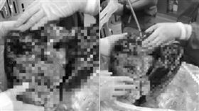 抽菸,菸齡,大陸,醫師,肺臟,焦黑,器捐
微博