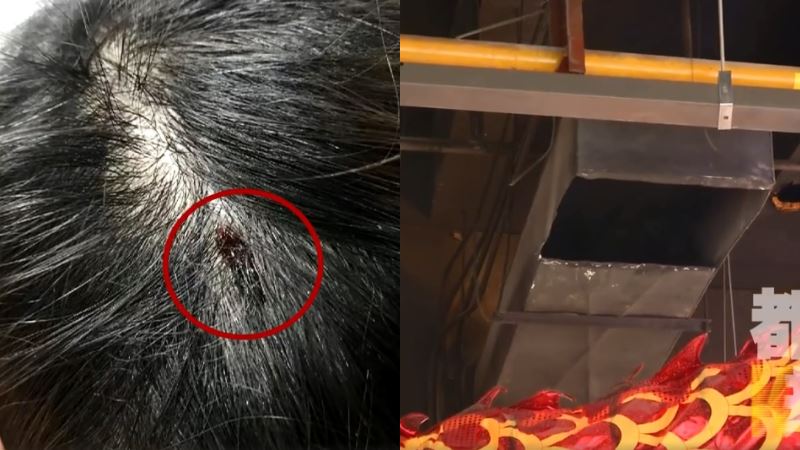女吃鍋遭天降老鼠咬破頭　店家竟拒賠
