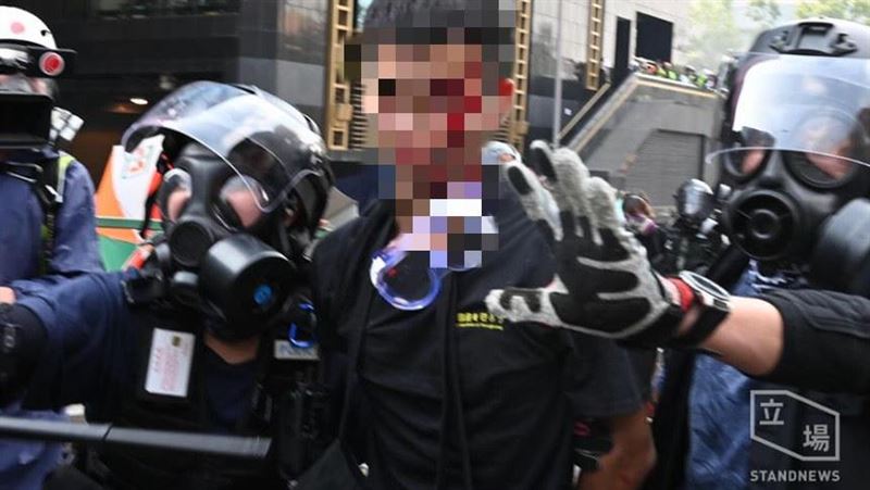 示威濺血！港教育局：19日繼續停課