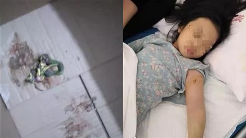 女兒手伸玩具箱爆哭　爸驚見毒蛇嚇歪