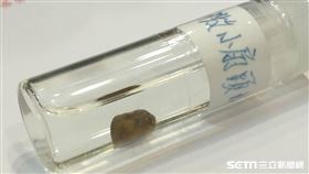 疾管署說明國內首見發熱伴血小板減少綜合症(SFTS)確定病例病情。（圖／記者楊晴雯攝）