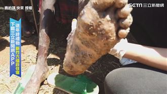 幫非洲孩洗腳除沙蚤　腳底潰爛長滿卵