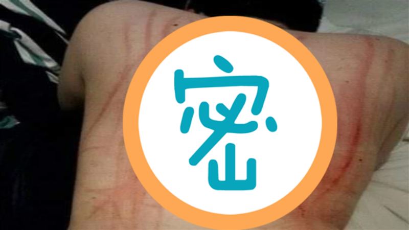 抓痕爬滿背！他自嗨技術好　網秒打臉