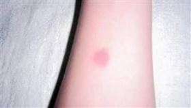 中國,守宮砂,處女,醫學,傳說