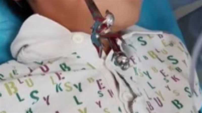 男童不慎跌倒！22公分玩具劍插臉