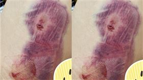 車禍4天…大腿瘀青浮出詭異女臉！　網驚「撞臉動漫角色」：富江出來了（圖／爆廢公社）