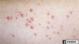 林旻憲醫師提供