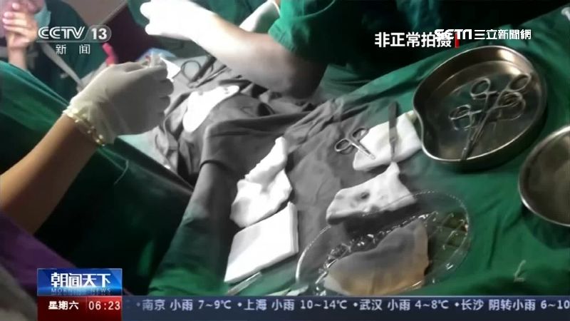要美還是要命？陸整形醫療亂象藏危機