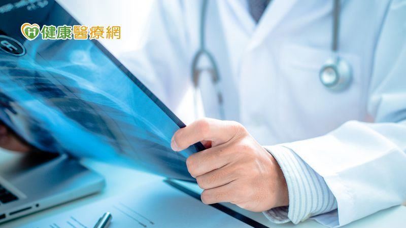 免疫療法搭化療　突破晚期肺癌困境