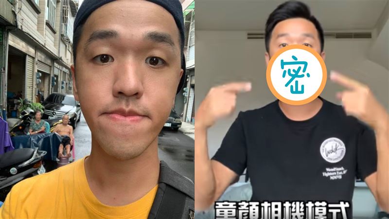 香蕉正顎手術近況曝！網：撞臉陳建州