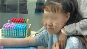 皺紋,衰老,少女,除皺,募捐,手術,老人,遺傳,基因,DNA,皮膚,　圖／翻攝自微博