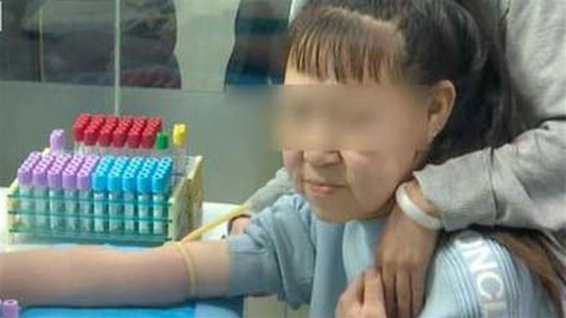 少女患病有張六旬老臉！讓她不敢上學
