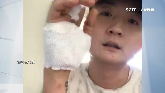 直播主喬債遭埋伏！左手險「斷掌」