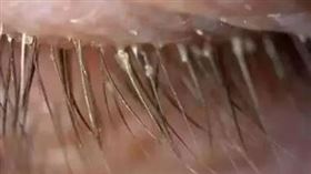 （圖／翻攝自微博）眼睛,睫毛,蟎蟲