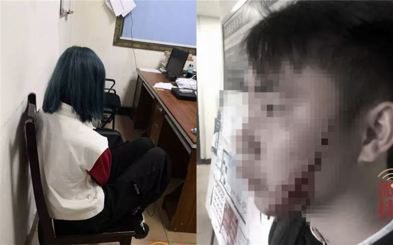 女分手最後擁抱！拿刀狠割男友嘴邊肉