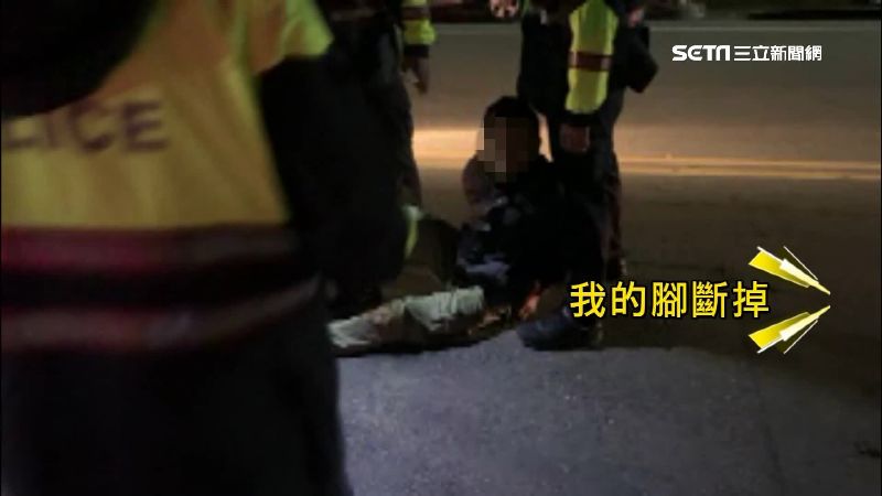 男斷腿執法過當？警：他不慎摔斷的