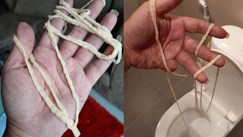 屎沒拉乾淨？他一扯驚見9.7米蟲蟲