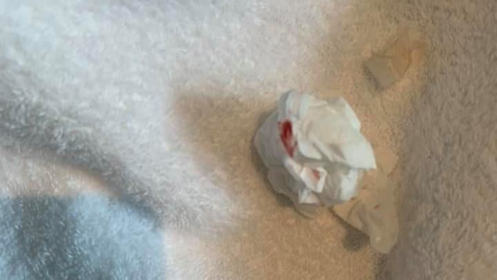 女星穿酒店浴袍　掏染血衛生紙團崩潰