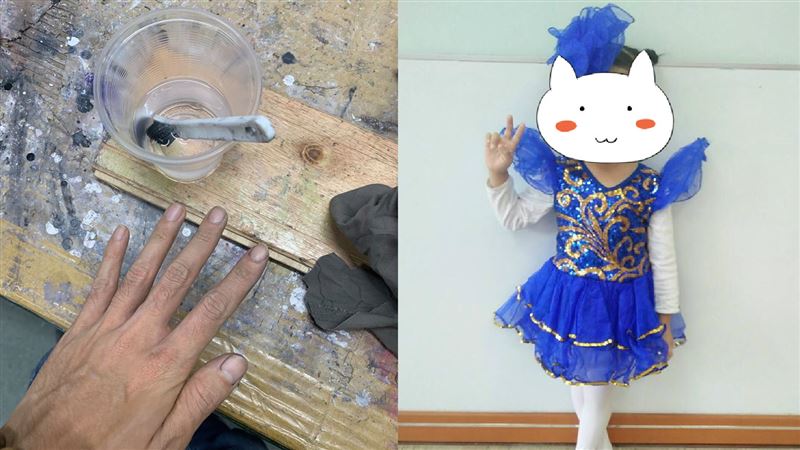 怕女兒丟臉！油漆父忍痛用強溶劑洗手