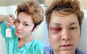 日本男偶像 間瀨翔太罹患罕見疾病「腦動脈畸形（AVM）」/手術。翻攝間瀨翔太IG