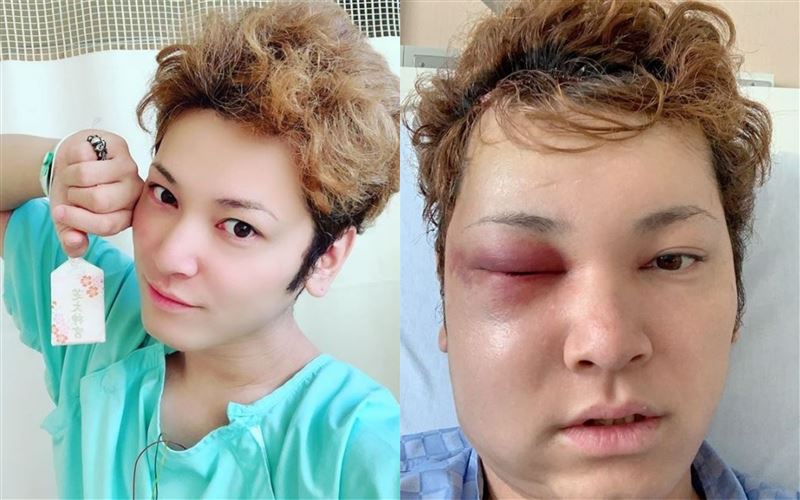 男星感冒吃藥沒好！頭爆痛才知罹罕病