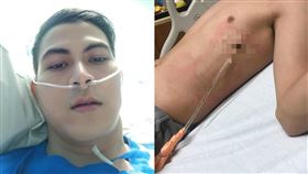 勸世文,抽菸,後悔,印尼,菸癮,學生,拍拖,呼吸器,副作用,肺,肺穿孔,焦油 圖／翻攝自臉書