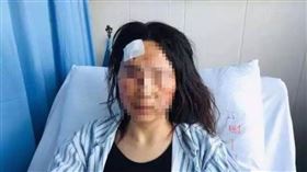 中國,家暴,毀容,餵屎（圖／翻攝自紅星新聞）