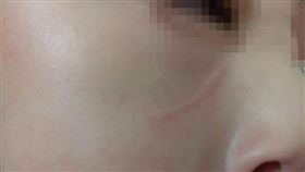 霸凌,幼兒園,掌摑,好玩,劃臉(爆料公社)